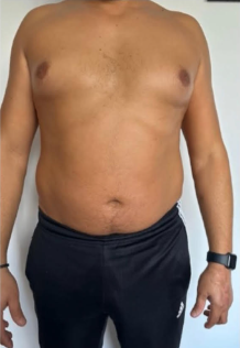 Lotfi avant transformation